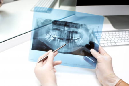 Radiografia Odontol Gica Quais S O Os Tipos E Como Funciona O Exame