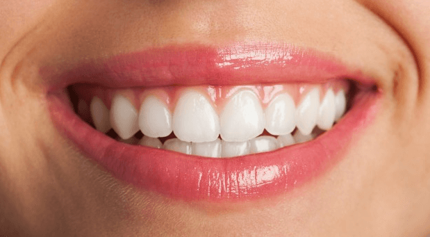 marketing odontologico dentes