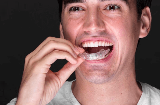 fotografia odontologica homem aparelho
