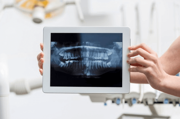 radiologia odontologica computador