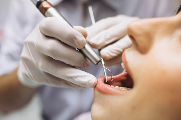 dentista recém formado boca