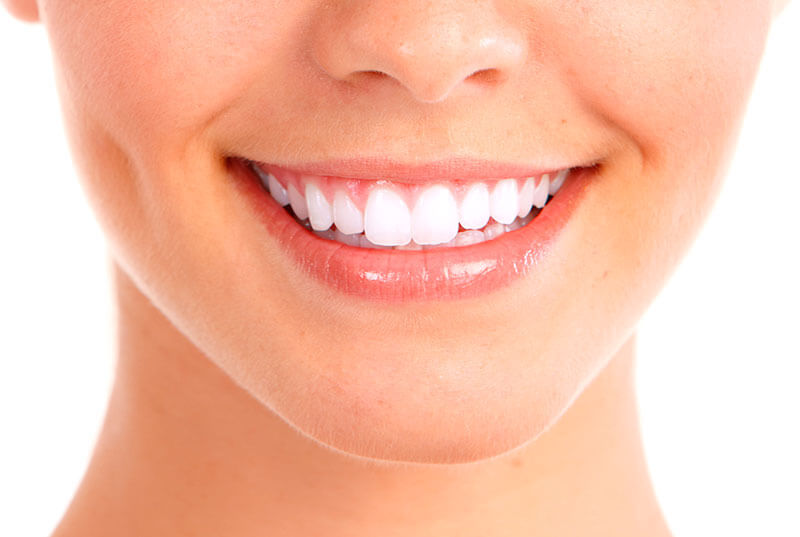 Implantodontia: paciente sorrindo