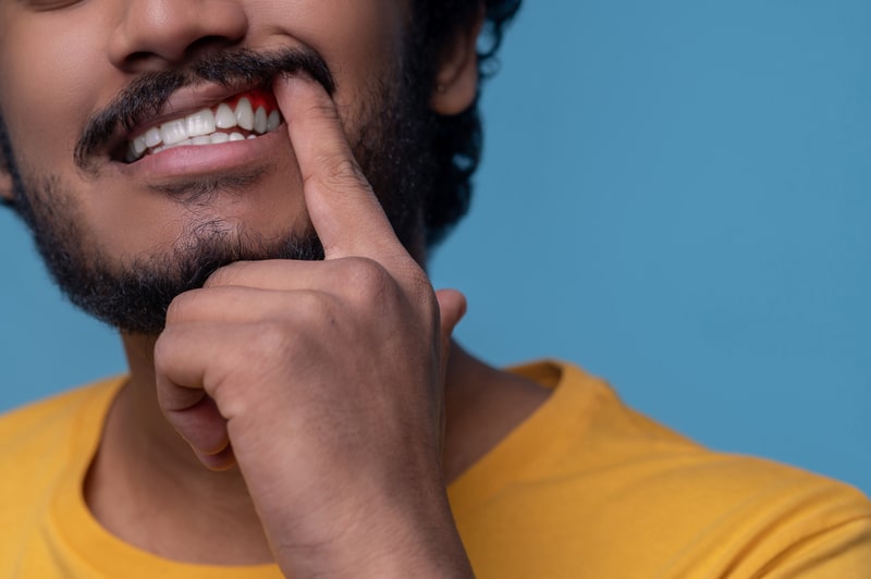 periodontia sorriso com dedo na boca