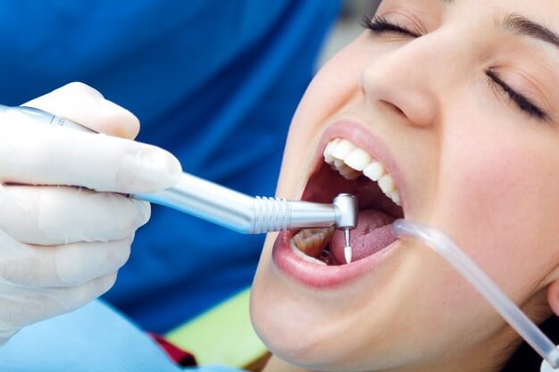 sedacao consciente dentista tratando os dentes da paciente