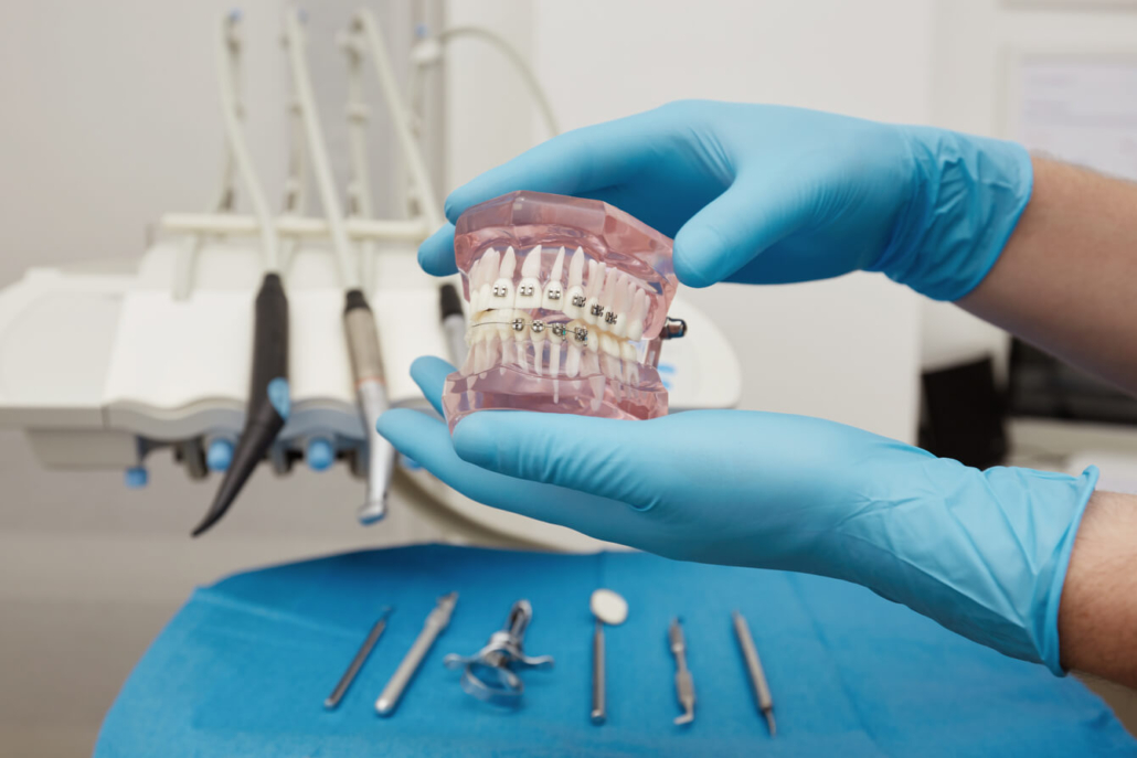 dentista mostrando aparelho especialização em ortodontia