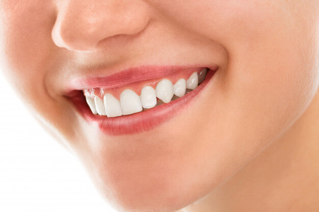 limas endodonticas sorriso
