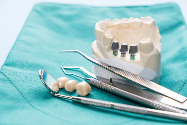 tipos de protese dentaria moderna instrumentos