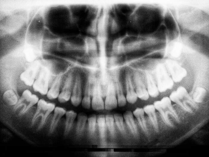 areas da odontologia raio x