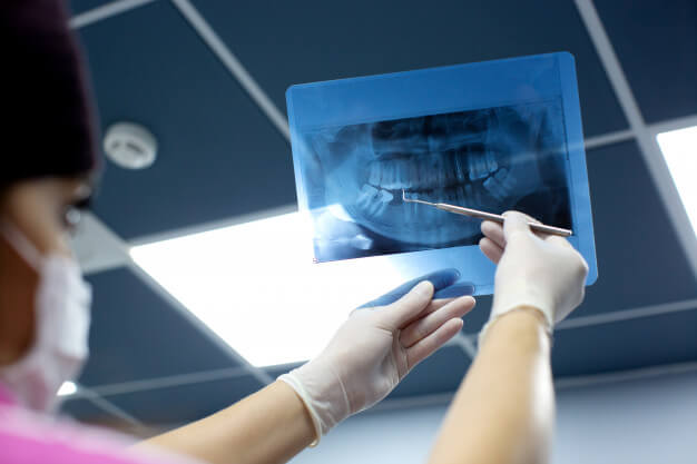 radiografia odontologica analise