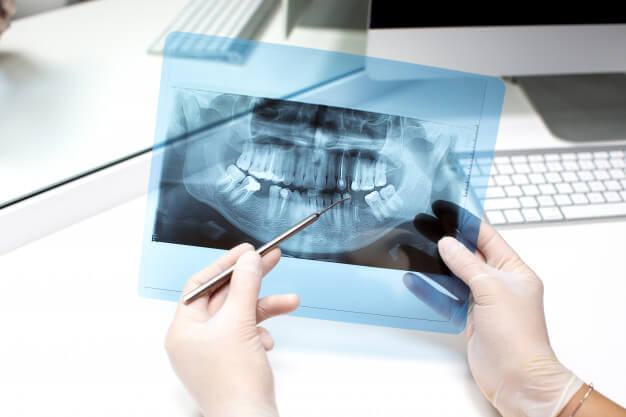 radiografia odontologica raio x