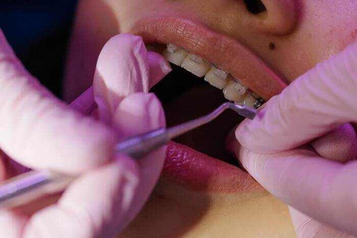 dentista clinico geral aparelho