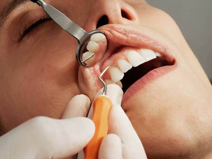 dentista clinico geral gengiva