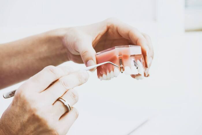 implantodontista demonstracao