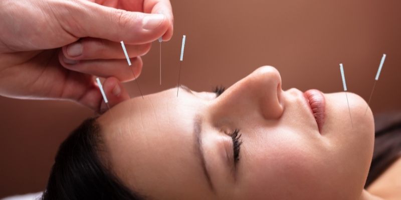 acupuntura acupuntura agulhas