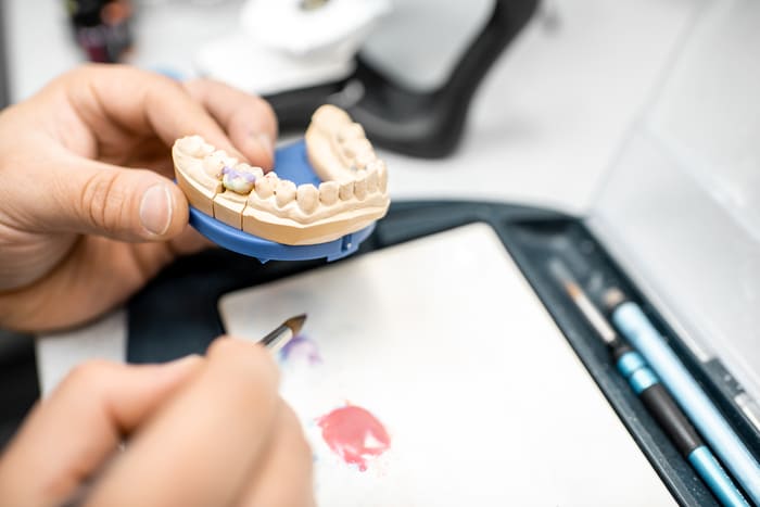 Impressora 3D odontologia Impressora 3D odontologia porcelana