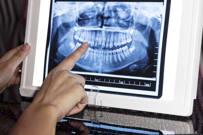 laudo odontologico radiografia