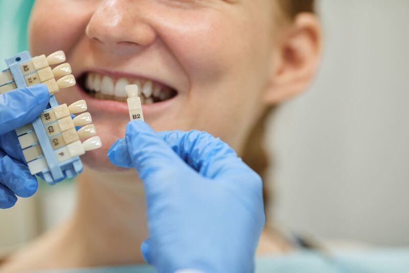mini implante ortodontico dentes