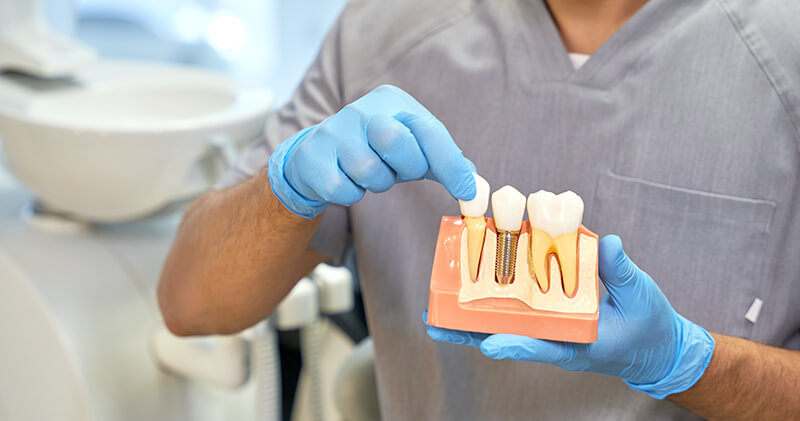 servico odontologico dentes